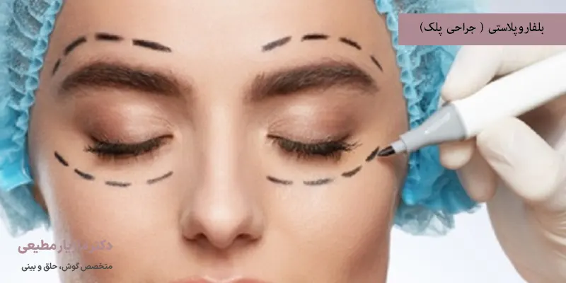 بلفاروپلاستی ( جراحی پلک)