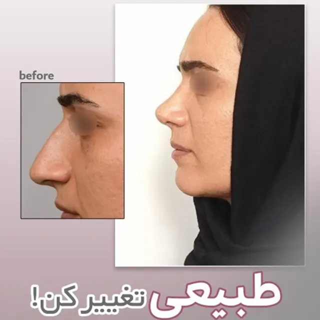 نمونه کار عمل بینی