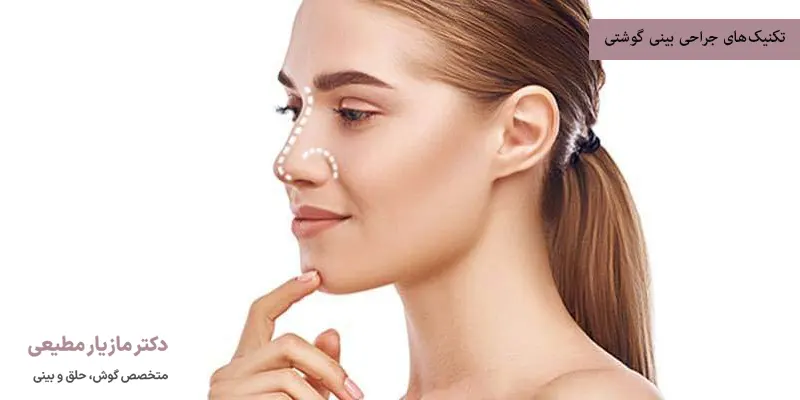 تکنیک‌های جراحی بینی گوشتی