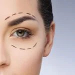 بهترین جراح بلفاروپلاستی - دکتر مازیار مطیعی