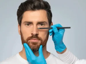 عمل بینی مردانه