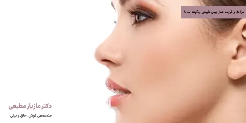 مراحل و فرایند عمل بینی طبیعی چگونه است؟