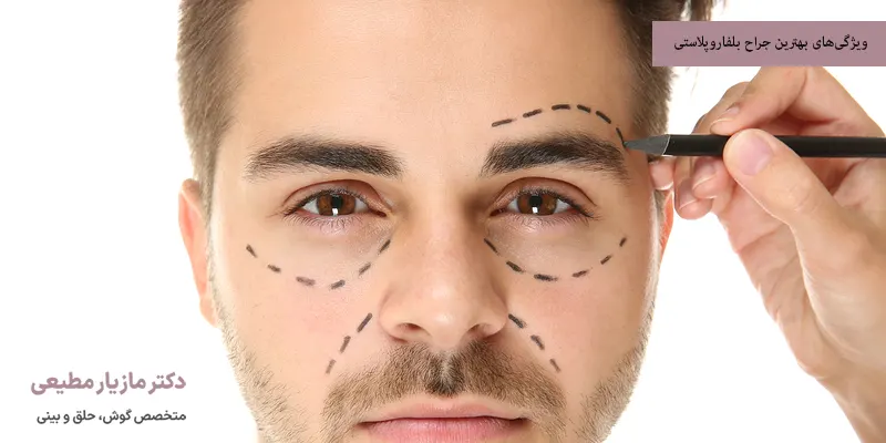 ویژگی‌های بهترین جراح بلفاروپلاستی
