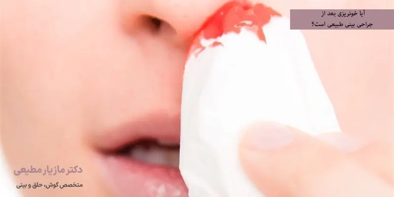 آیا خونریزی بعد از جراحی بینی طبیعی است؟