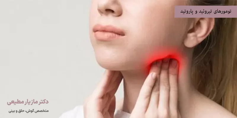 تومورهای تیروئید و پاروتید