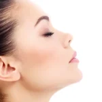 جراحی بینی فانتزی