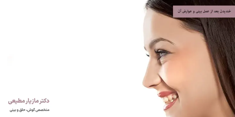 خندیدن بعد از عمل بینی و عوارض آن