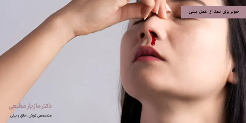 خونریزی بعد از عمل بینی