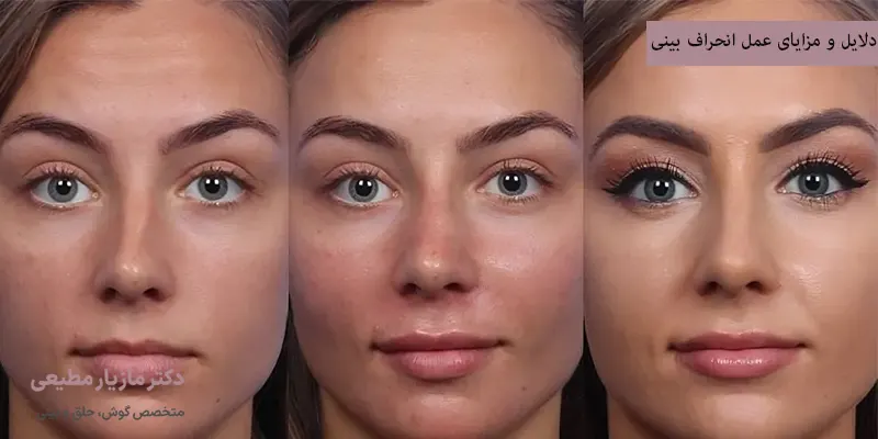 دلایل و مزایای عمل انحراف بینی