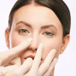 عدم تقارن سوراخ های بینی