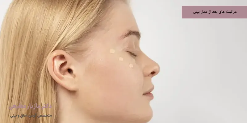 مراقبت های بعد از عمل بینی