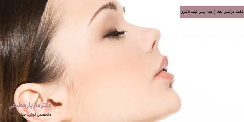 نکات مراقبتی بعد از عمل بینی نیمه فانتزی