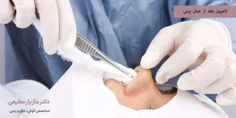 تامپون بعد از عمل بینی