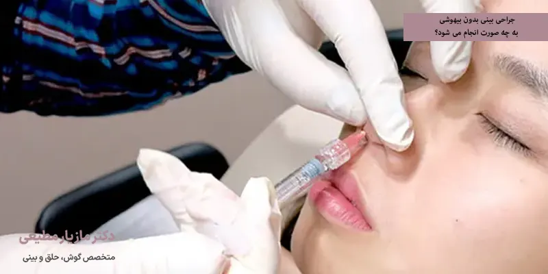 جراحی بینی بدون بیهوشی به چه صورت انجام می شود؟