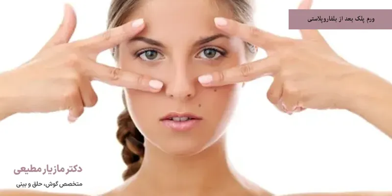ورم پلک بعد از بلفاروپلاستی