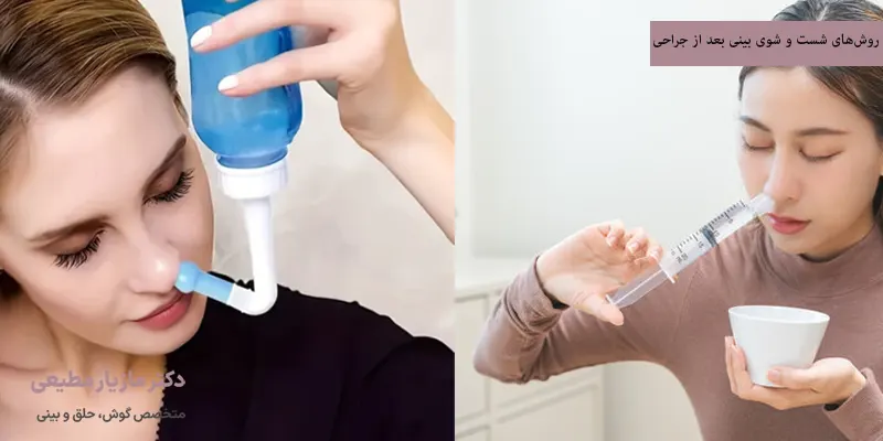 روش‌های شست ‌و شوی بینی بعد از جراحی
