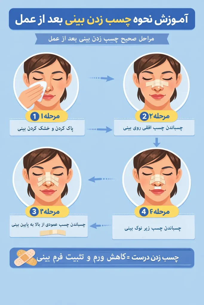 روند چسب زدن بینی بعد از عمل