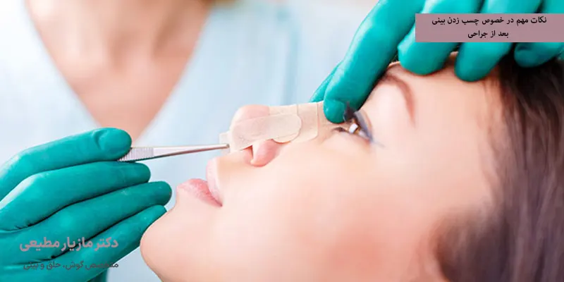 نکات مهم در خصوص چسب زدن بینی بعد از جراحی