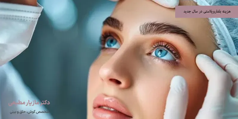 هزینه بلفاروپلاستی در سال 1404