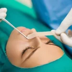 چسب بینی بعد از جراحی