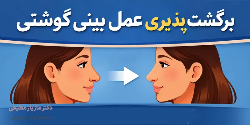 برگشت پذیری عمل بینی گوشتی