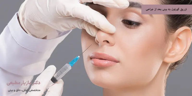 تزریق کورتون به بینی بعد از جراحی