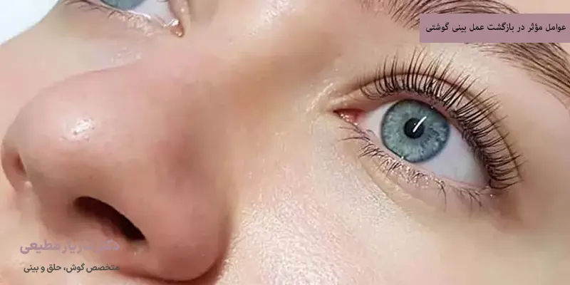 عوامل مؤثر در بازگشت عمل بینی گوشتی