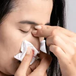 عفونت بعد از عمل بینی