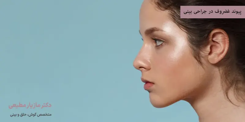 پیوند غضروف در جراحی بینی