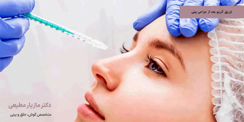 تزریق آنزیم بعد از جراحی بینی