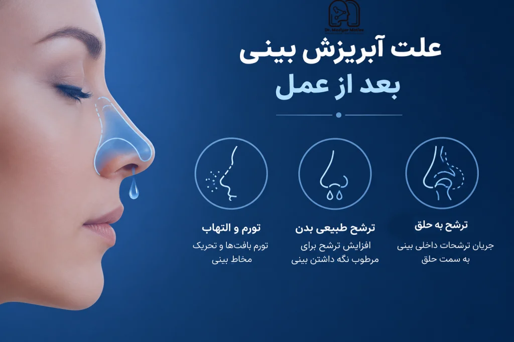 علت آبریزش بینی بعد از عمل