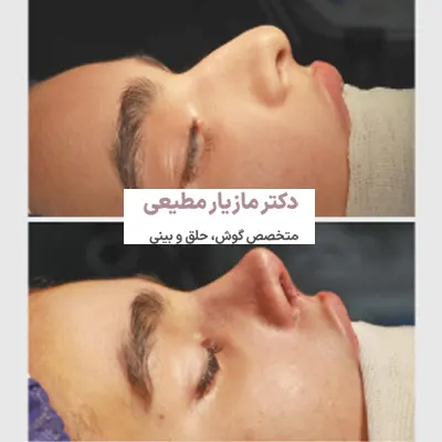 نمونه کار طبیعی