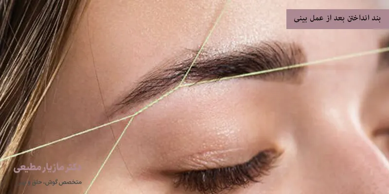 بند انداختن