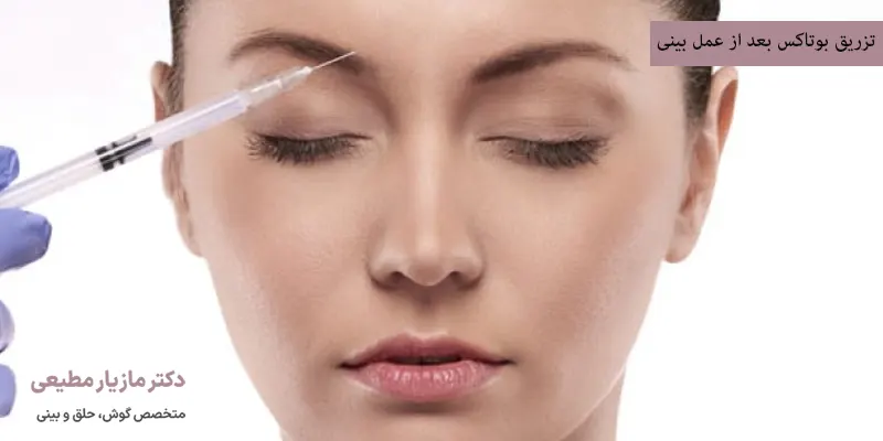 تزریق بوتاکس بعد از عمل بینی