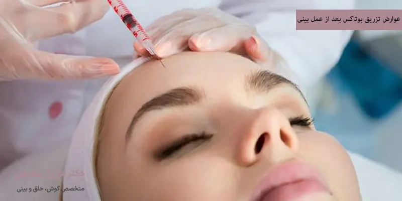 عوارض تزریق بوتاکس بعد از عمل بینی