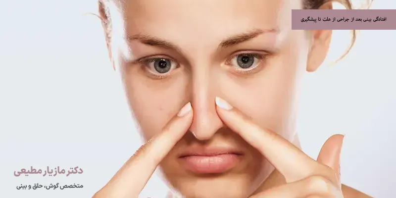 افتادگی بینی بعد از جراحی از علت تا پیشگیری