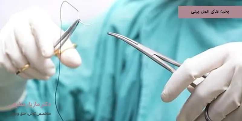 بخیه های عمل بینی