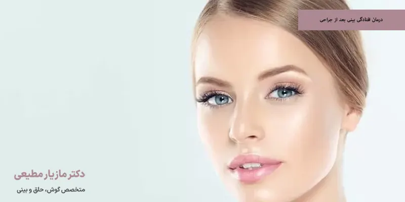 درمان افتادگی بینی بعد از جراحی