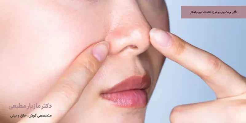 تأثیر پوست بینی بر دوران نقاهت، تورم و اسکار