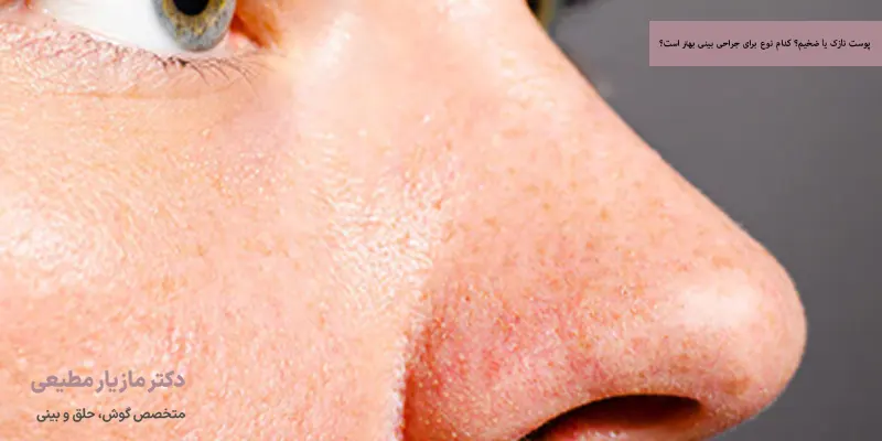 پوست نازک یا ضخیم؟ کدام نوع برای جراحی بینی بهتر است؟