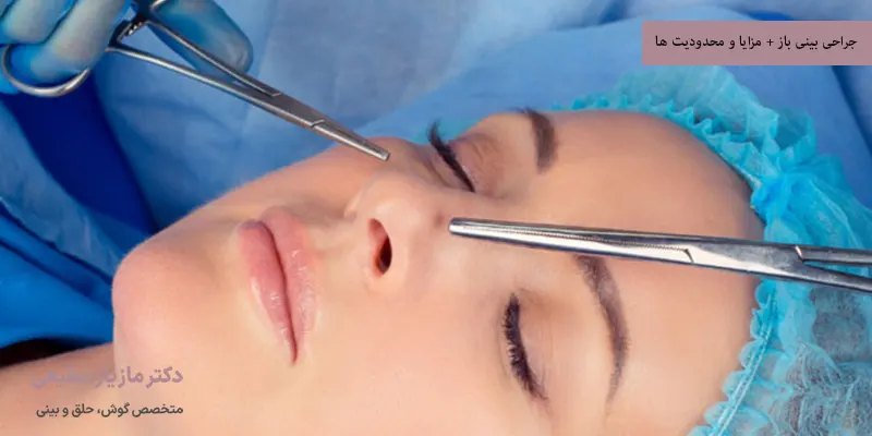 جراحی بینی باز + مزایا و محدودیت ها