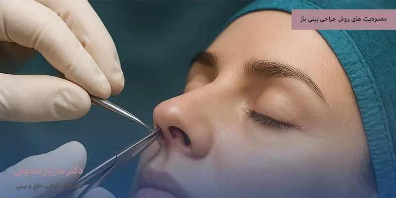 محدودیت‌ های روش جراحی بینی باز