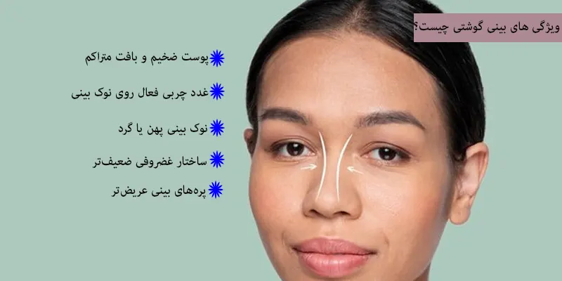 ویژگی های بینی گوشتی
