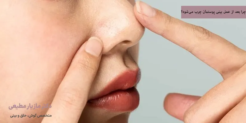 چرا بعد از عمل بینی پوستمان چرب می‌شود؟