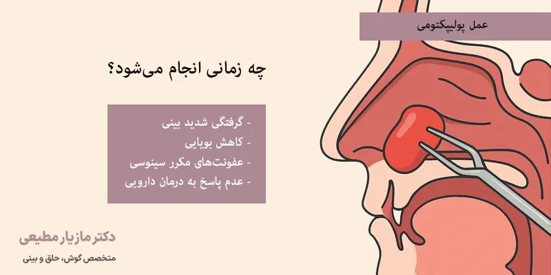عمل پولیپکتومی