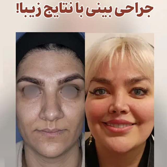 عمل بینی نیمه فانتزی دکتر مطیعی