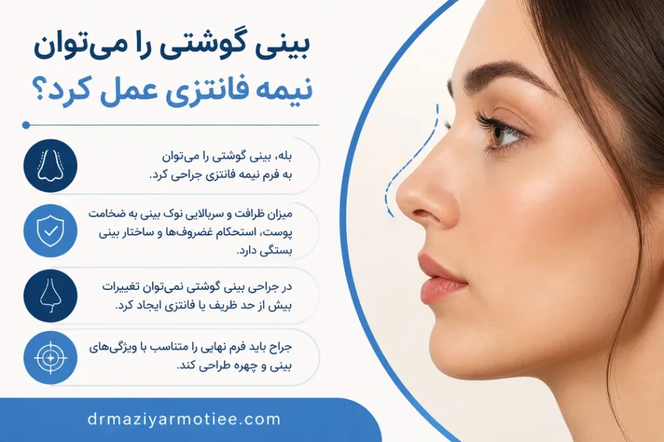 نمای توضیحی درباره بینی گوشتی را میتوان نیمه فانتزی عمل کرد